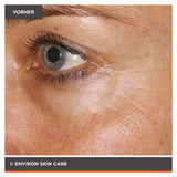 ENVIRON - Focus Care Youth+ Tri-Peptide Complex+ Avance Elixir - Feuchtigkeitspflege - Environ Skin Care - ZEITWUNDER Onlineshop - Kosmetik online kaufen
