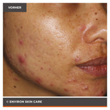 ENVIRON - Focus Care Clarity+ Vita-Botanical Sebu-ACE Oil - Feuchtigkeitspflege - Environ Skin Care - ZEITWUNDER Onlineshop - Kosmetik online kaufen