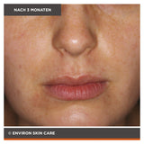 ENVIRON - Focus Care Clarity+ Botanical Infused Sebu-Tone Clarifier - Toner - Environ Skin Care - ZEITWUNDER Onlineshop - Kosmetik online kaufen