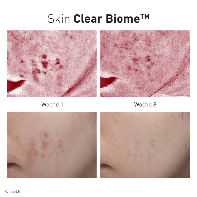 Advanced Nutrition Programme - Skin Clear Biome - Limited Edition - Nahrungsergänzung - Advanced Nutrition Programme - ZEITWUNDER Onlineshop - Kosmetik online kaufen