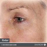 ENVIRON - Youth EssentiA - Vita-Peptide - Eye Gel - Feuchtigkeitspflege - Environ Skin Care - ZEITWUNDER Onlineshop - Kosmetik online kaufen