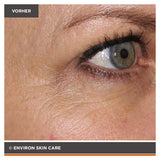 ENVIRON - Focus Care Youth+ Tri BioBotanical Revival Masque - Gesichtsmaske - Environ Skin Care - ZEITWUNDER Onlineshop - Kosmetik online kaufen
