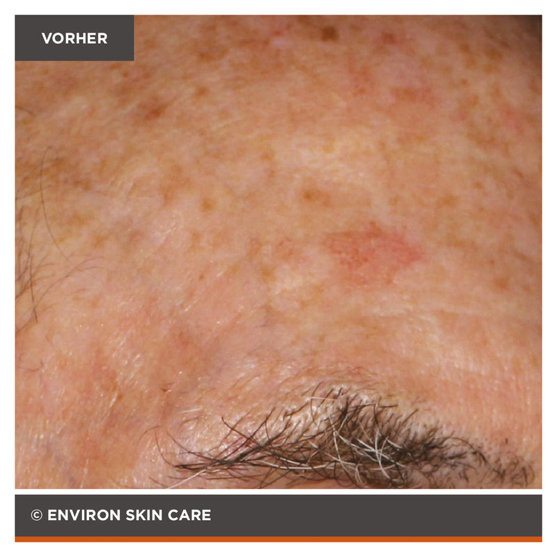 ENVIRON - Focus Care Radiance+ Vita-Botanical Mela-Fade Serum - Spezialpflege - Environ Skin Care - ZEITWUNDER Onlineshop - Kosmetik online kaufen