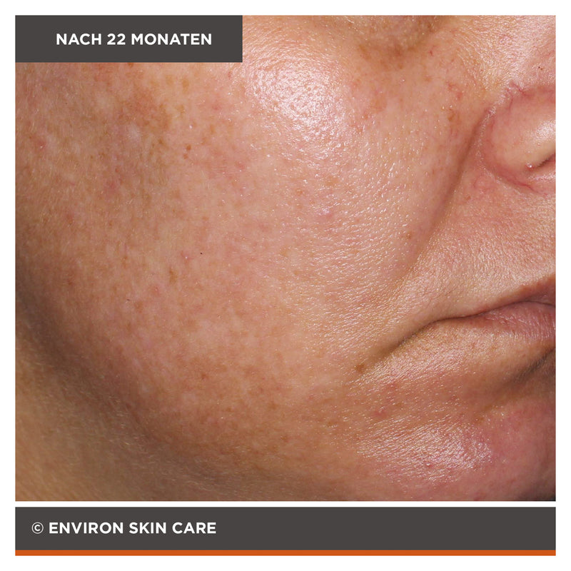 ENVIRON - Focus Care Radiance+ Intense C-Boost Mela-Even Cream - Feuchtigkeitspflege - Environ Skin Care - ZEITWUNDER Onlineshop - Kosmetik online kaufen