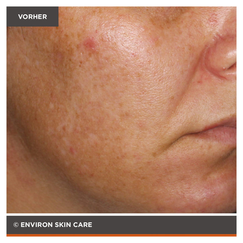 ENVIRON - Focus Care Radiance+ Intense C-Boost Mela-Even Cream - Feuchtigkeitspflege - Environ Skin Care - ZEITWUNDER Onlineshop - Kosmetik online kaufen