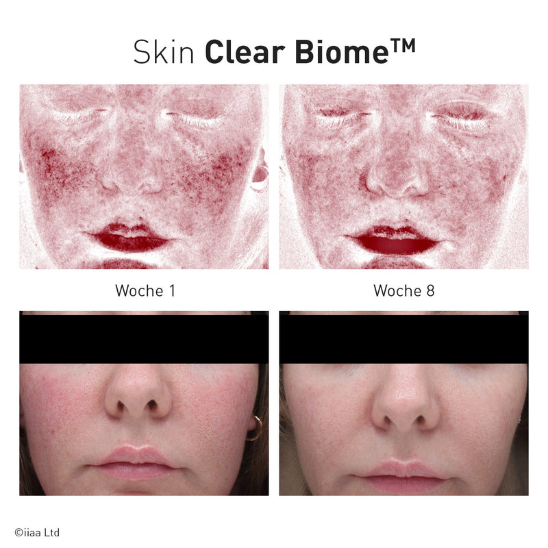 Advanced Nutrition Programme - Skin Clear Biome - Limited Edition - Nahrungsergänzung - Advanced Nutrition Programme - ZEITWUNDER Onlineshop - Kosmetik online kaufen